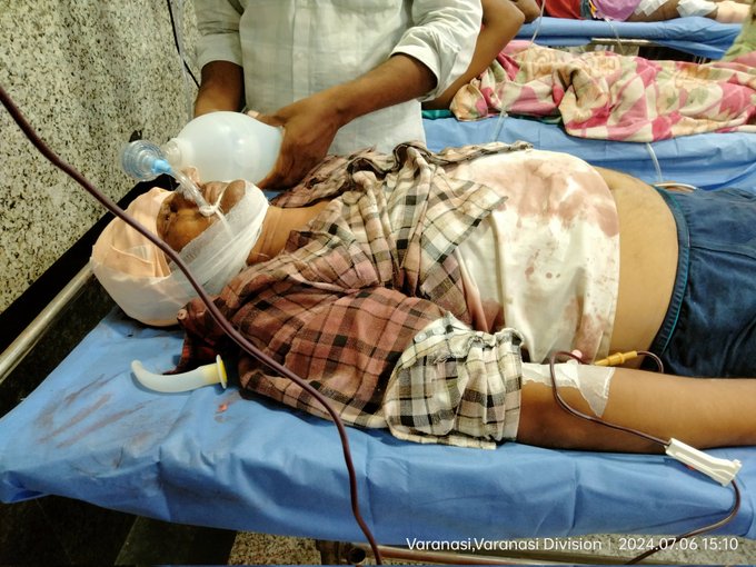 Ajay Prajapati in Trauma centre, BHU